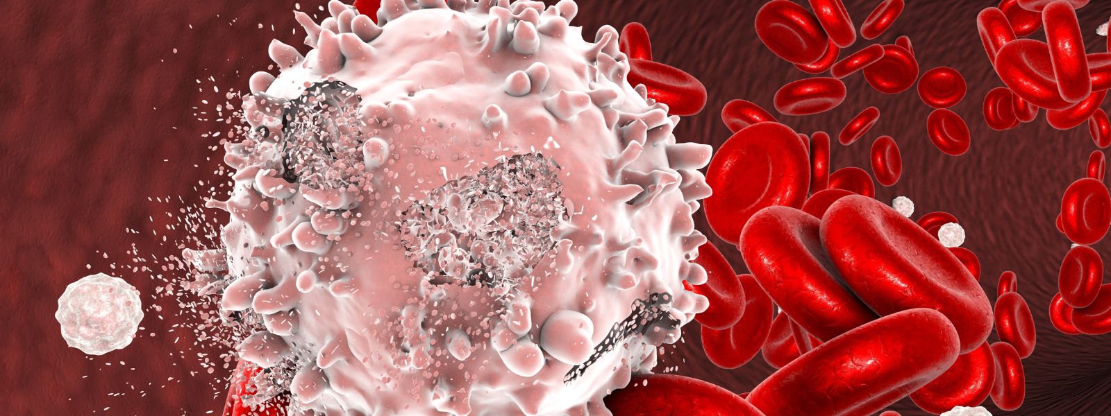 2000 Blood Cancer Cases Recorded Annually